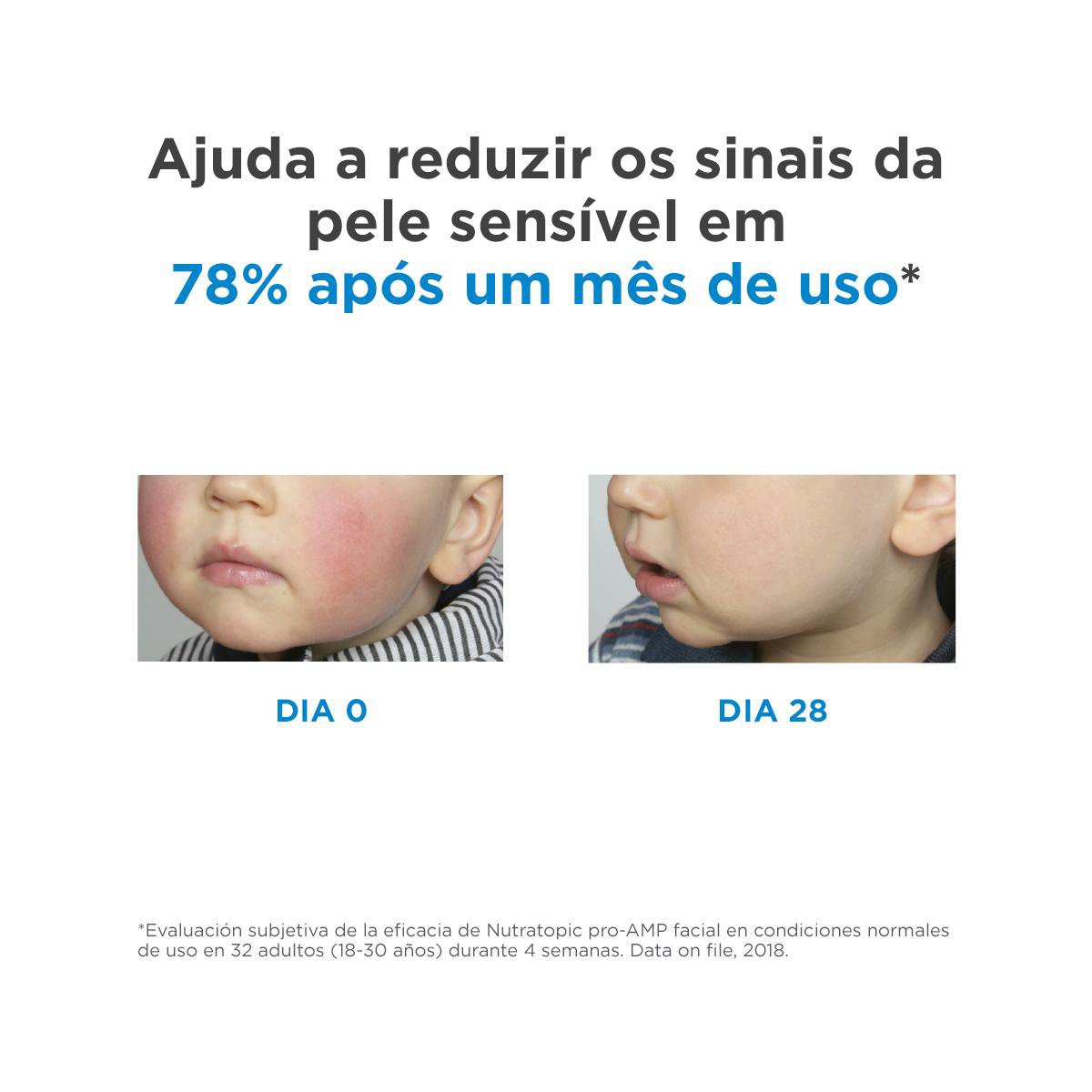 Creme Facial ISDIN Nutratopic Pro-AMP Pele Atópica 50ml — imagem 3 | Drogaria Taveira