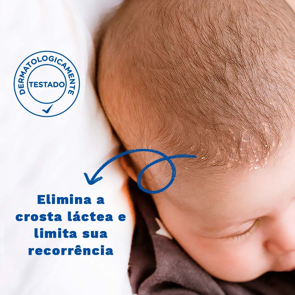 Creme para Crosta Láctea Mustela Stelaker Bebê Hipoalergênico 40ml — imagem 3 | Drogaria Taveira