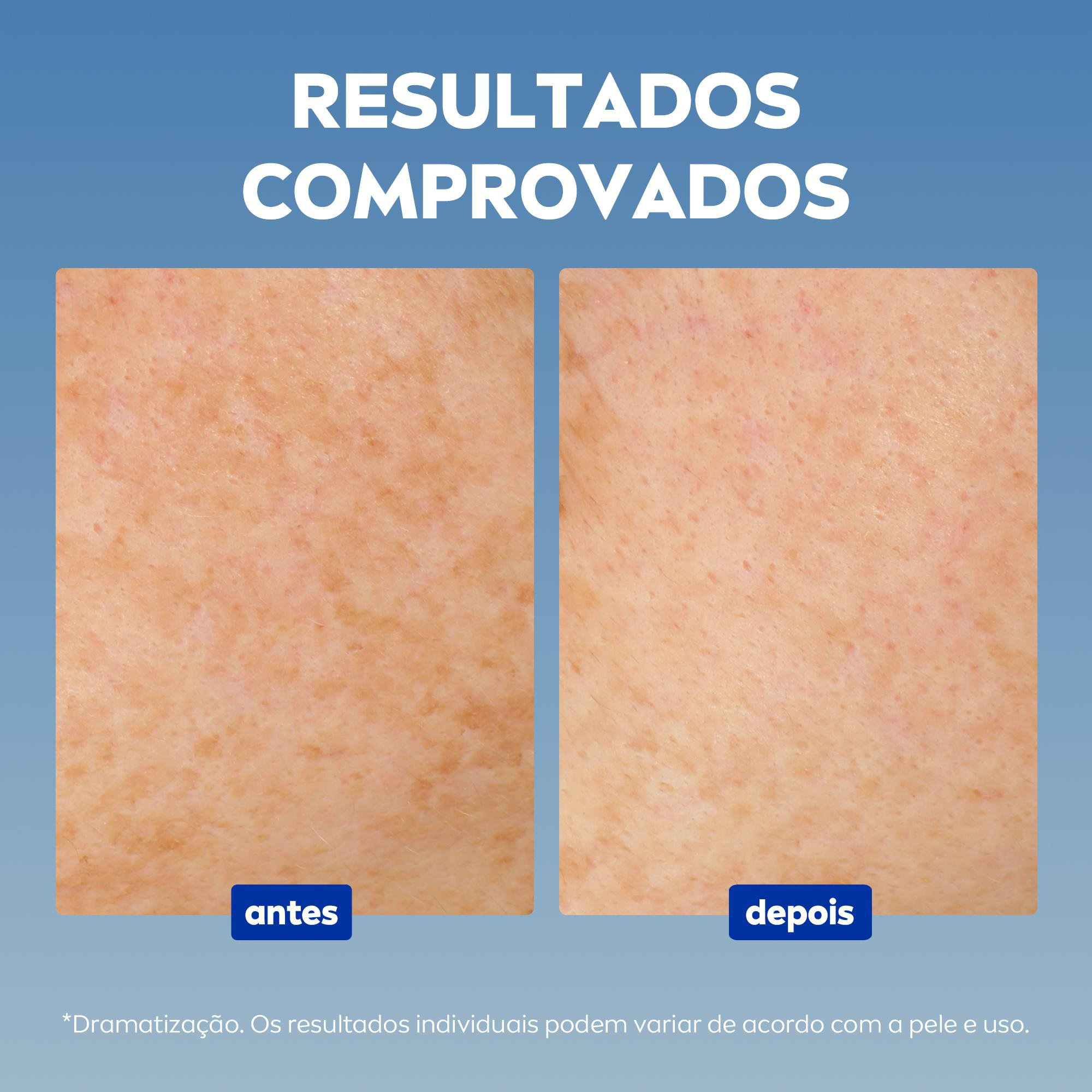 Fluido Facial Nivea Cellular Luminous 630 Antimanchas FPS 50 40ml — imagem 4 | Drogaria Taveira