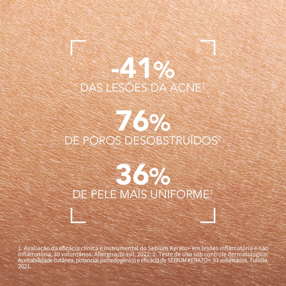Gel Creme Facial Bioderma Sébium Kerato+ Antiacne e Antimarcas 30ml — imagem 4 | Drogaria Taveira
