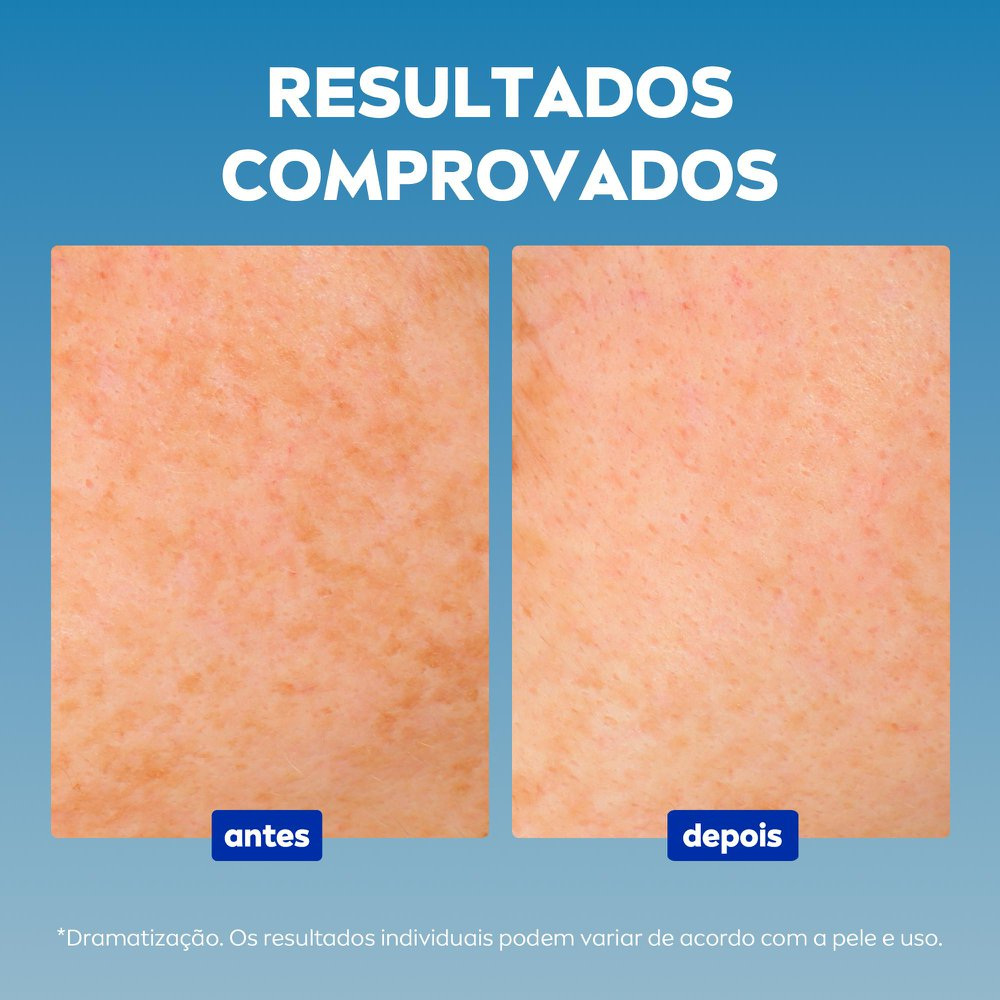 Sérum Facial Nivea Cellular Luminous 630 Antispot 30ml — imagem 4 | Drogaria Taveira
